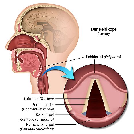 Schaubild zur anatomischen Erklärung von Heiserkeit